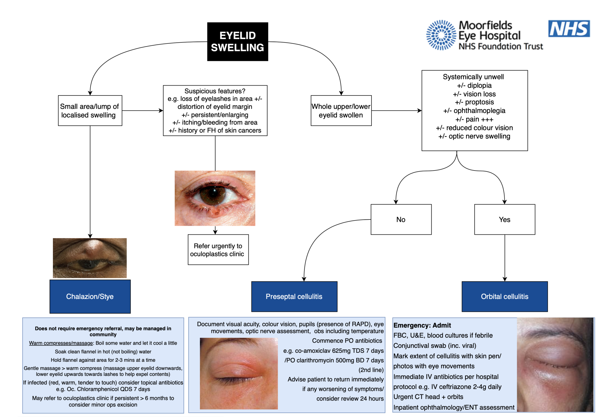 Management of Common Eye Conditions – GP Gateway