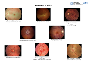 Management of Common Eye Conditions – GP Gateway